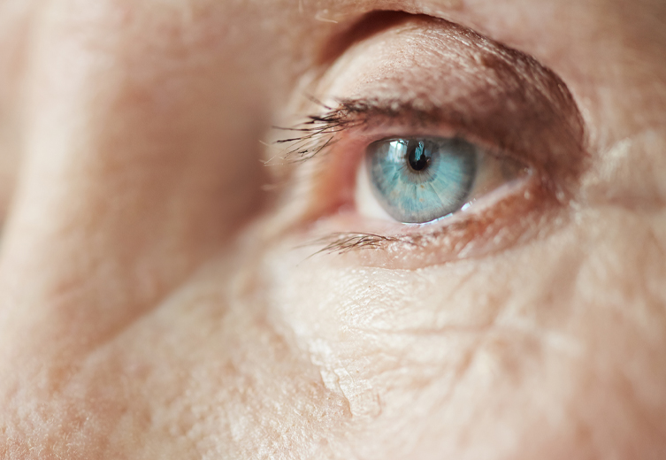 Exames para glaucoma