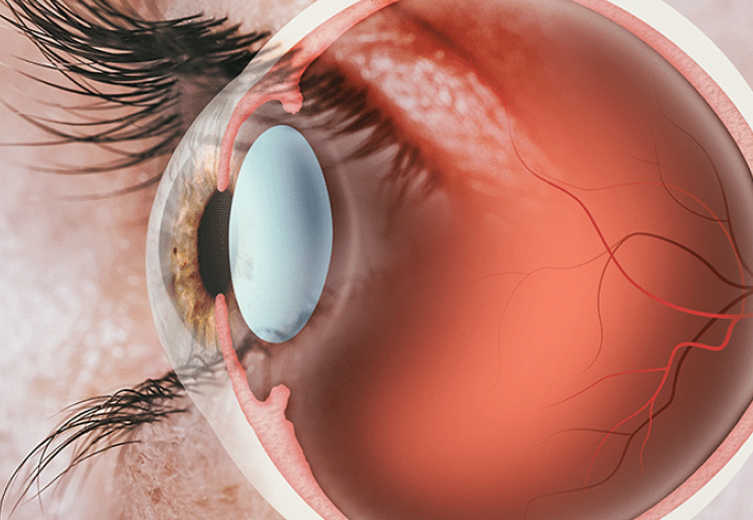 Retina