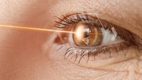Tratamento do glaucoma